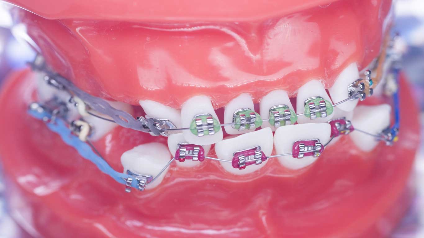 difference between orthodontist and dentist
