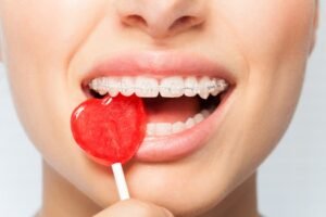 The worst candies for your teeth