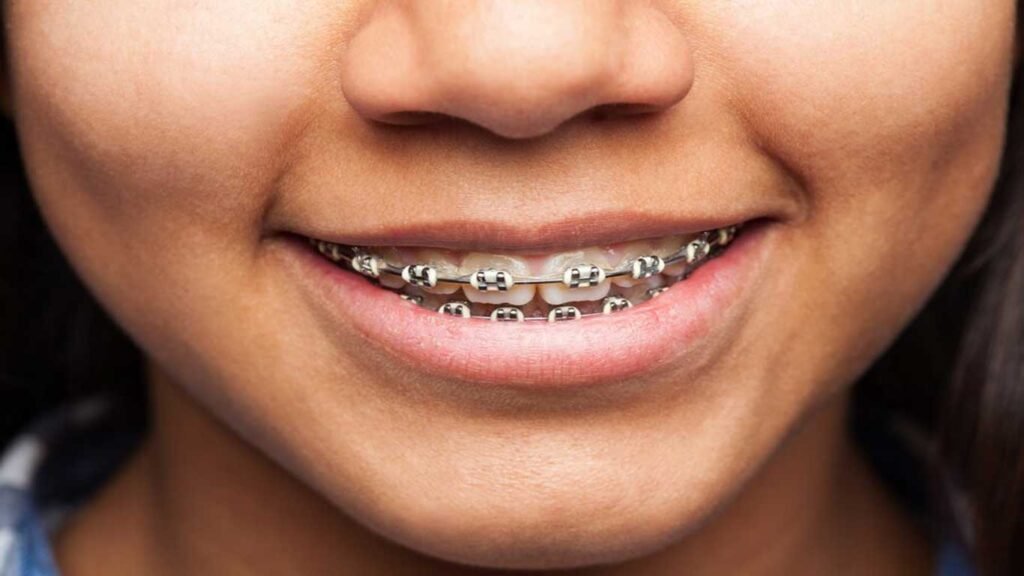 orthodontic treatment