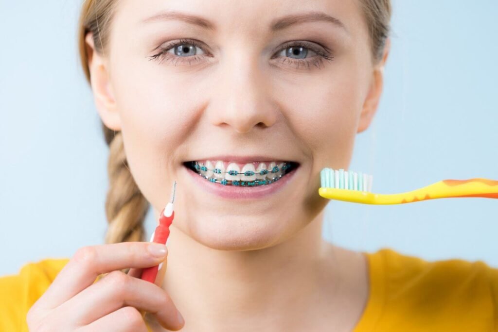 What To Expect When Getting Braces Orthodontic Services