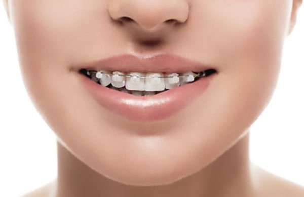 FAQ for your Orthodontist