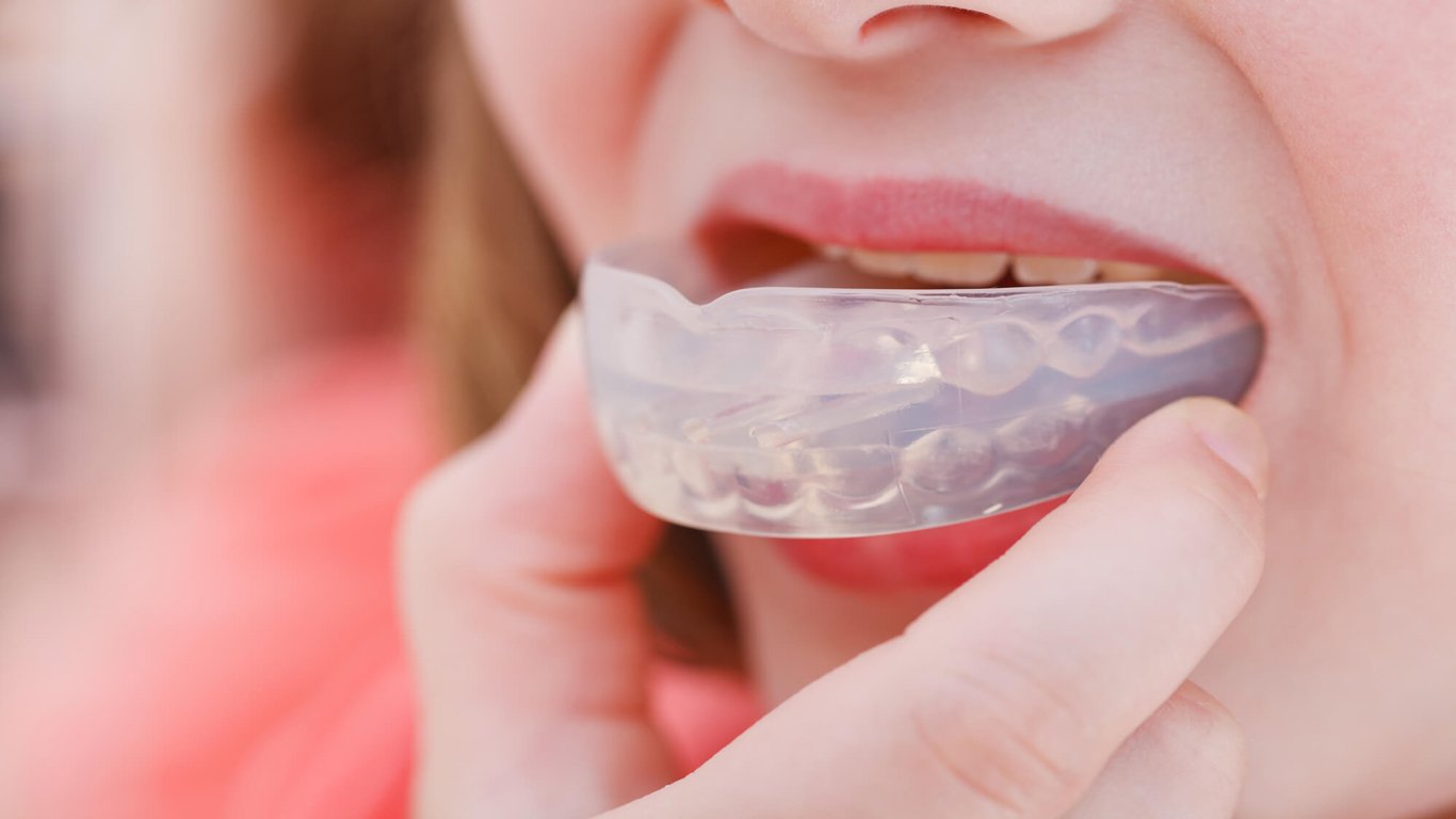 What Are Night Retainers, And Can They Straighten Teeth?