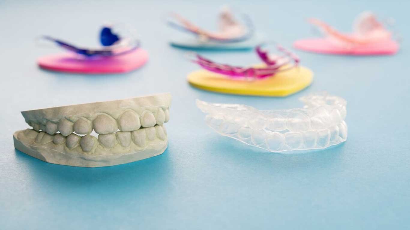 plastic clear retainer