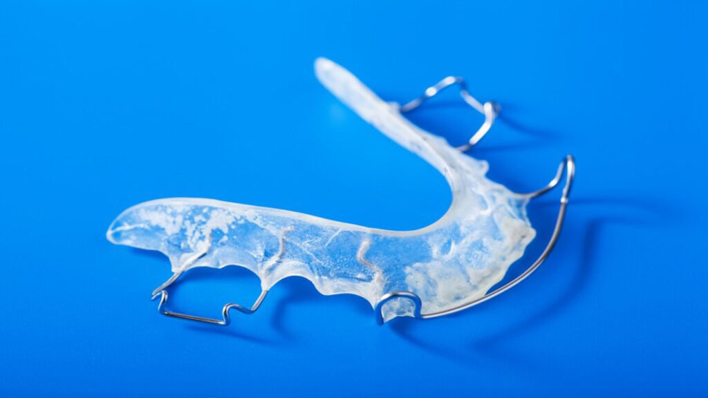 metal retainers