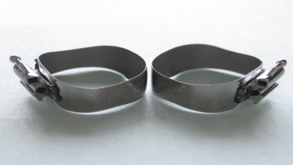 Molar Bands With Cleats In Orthodontics Takeaways For 2023