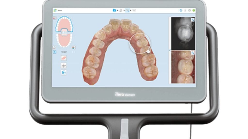 iTero Invisalign Scanner