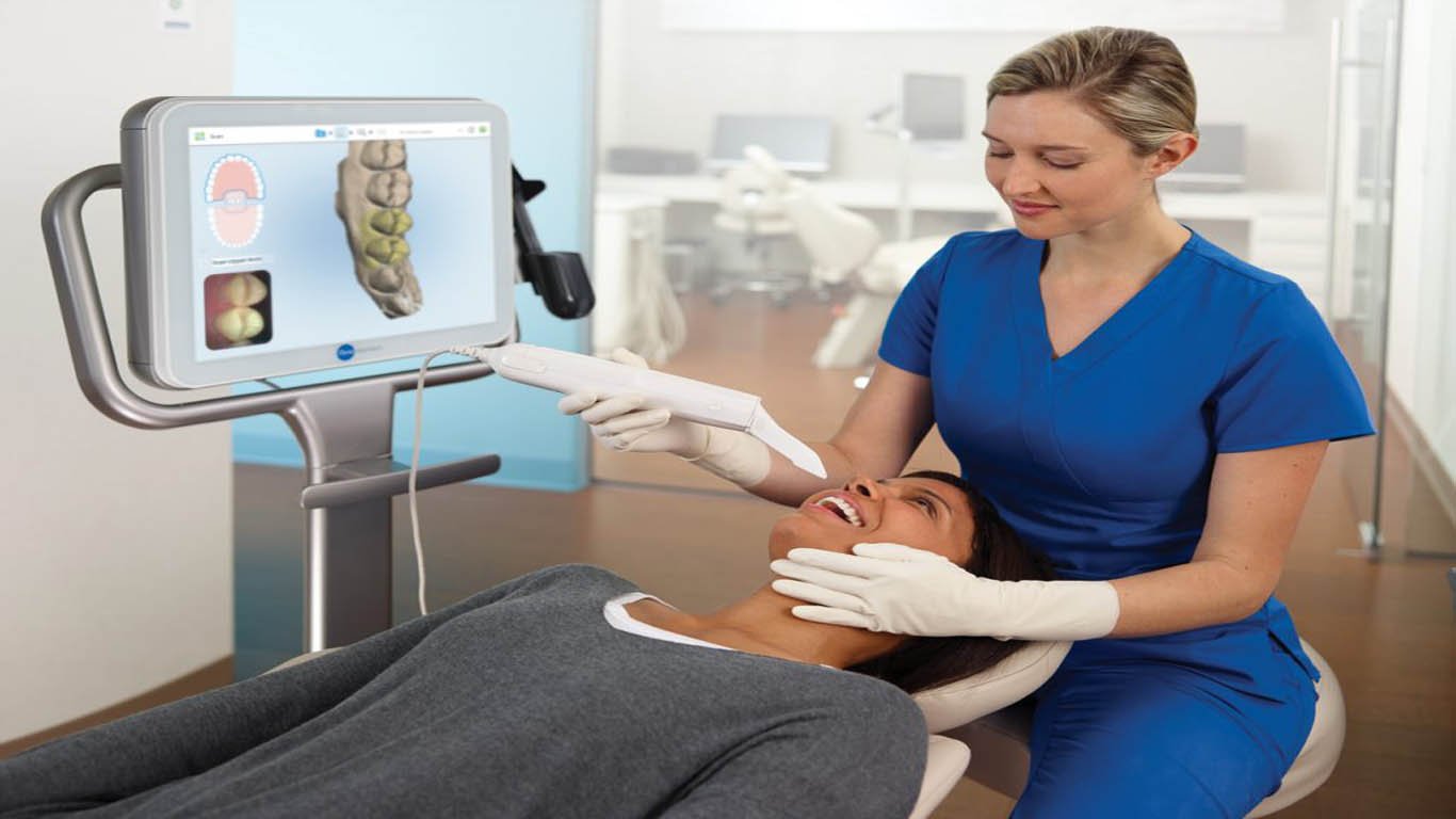 the advantages of iTero Invisalign scanner