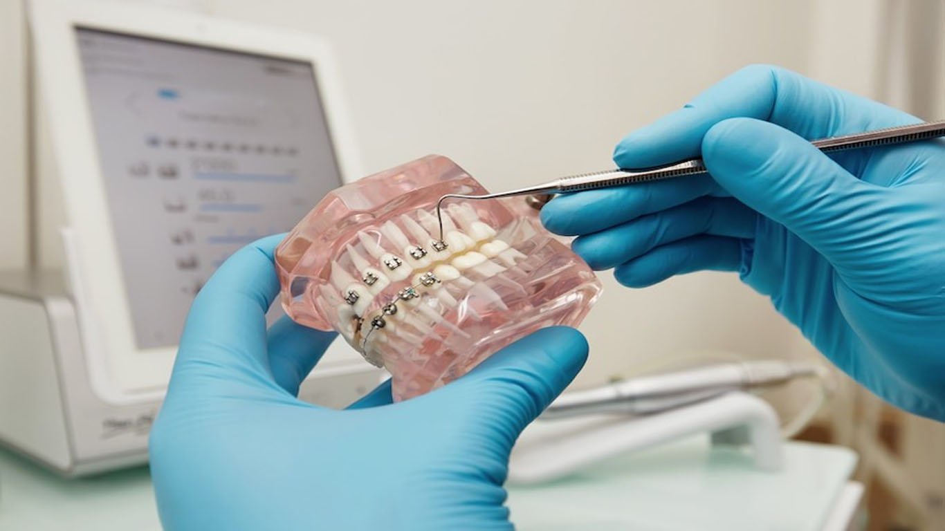 alternative options to orthognatic surgery-orthodontic camouflage treatments