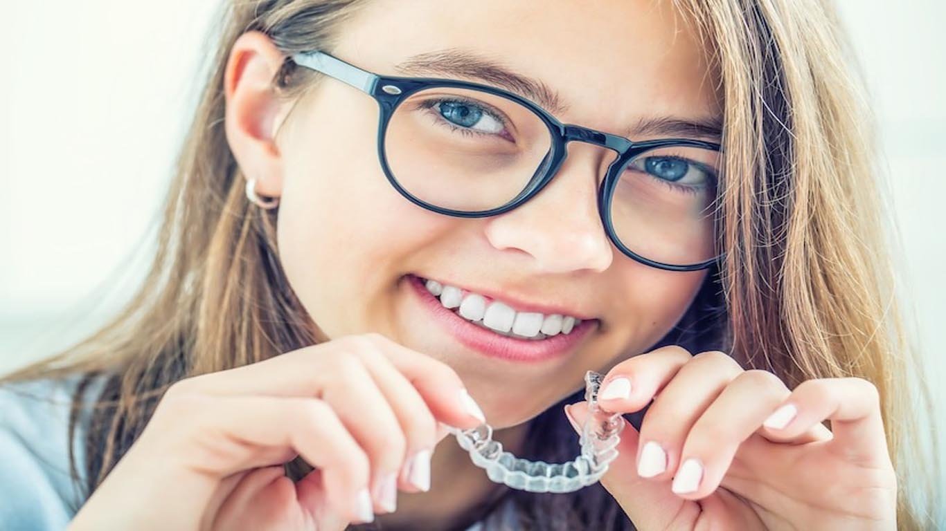 Clear aligners-types of braces