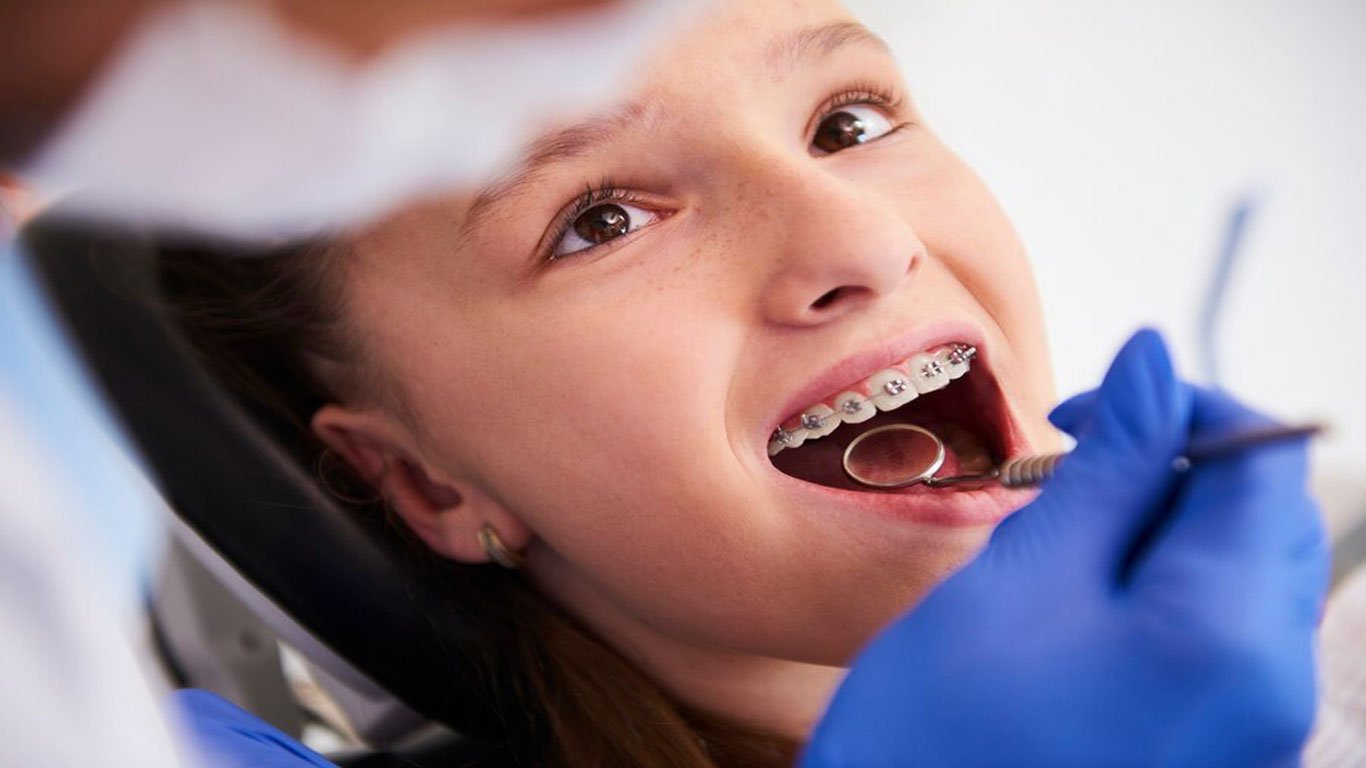 dental braces consultation