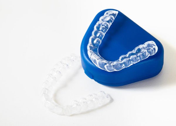 Invisalign aligners