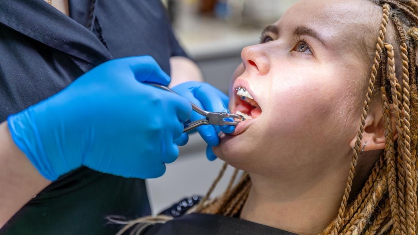 how much are braces in Ontario