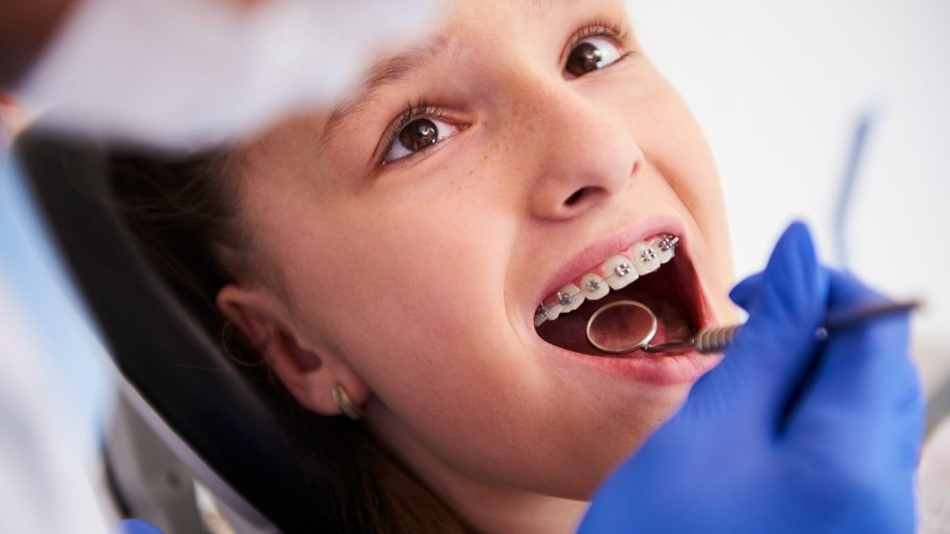 how expensive are braces in Canada