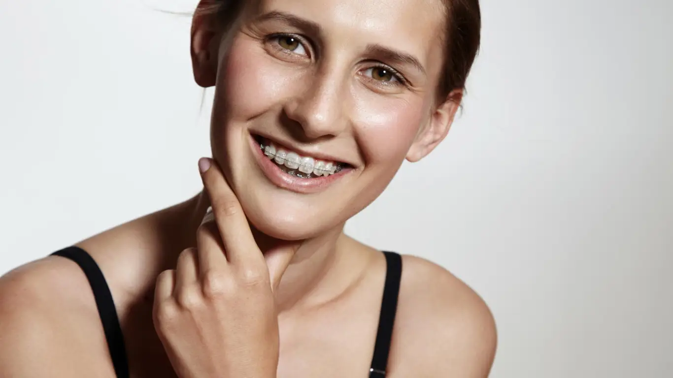 ceramic braces-dental teeth braces