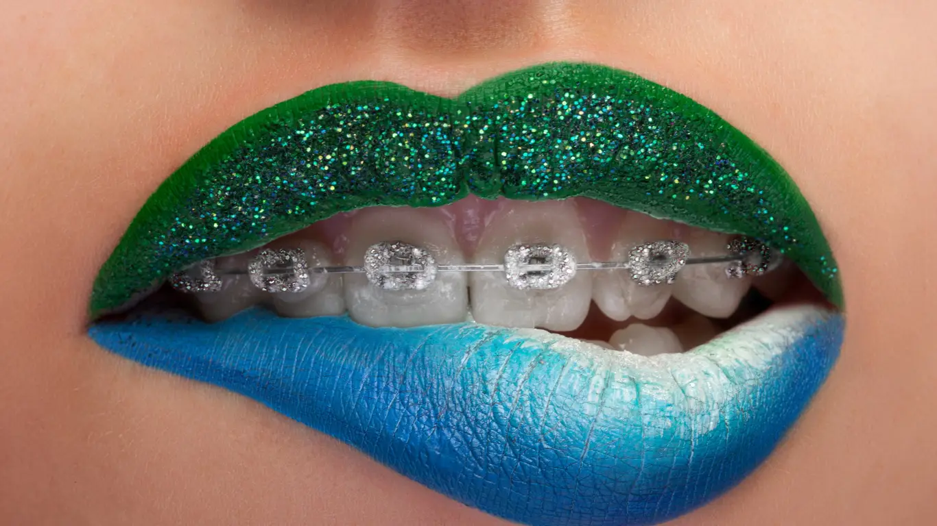 ceramic braces vs. metal braces