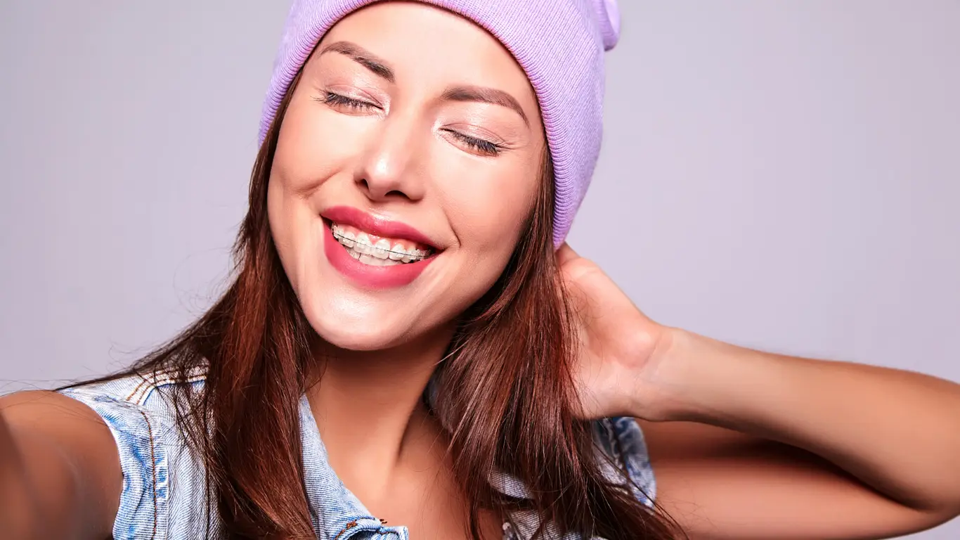 transparent clear braces