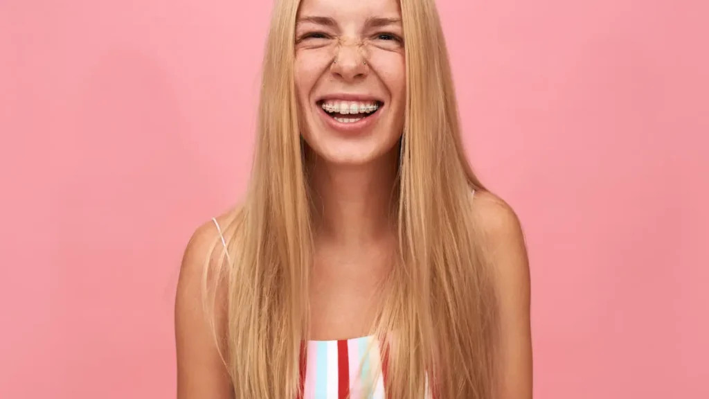 clear orthodontic braces