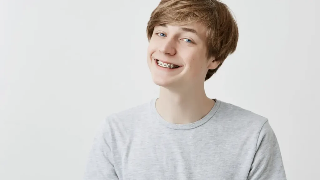 how long do you have to wear braces