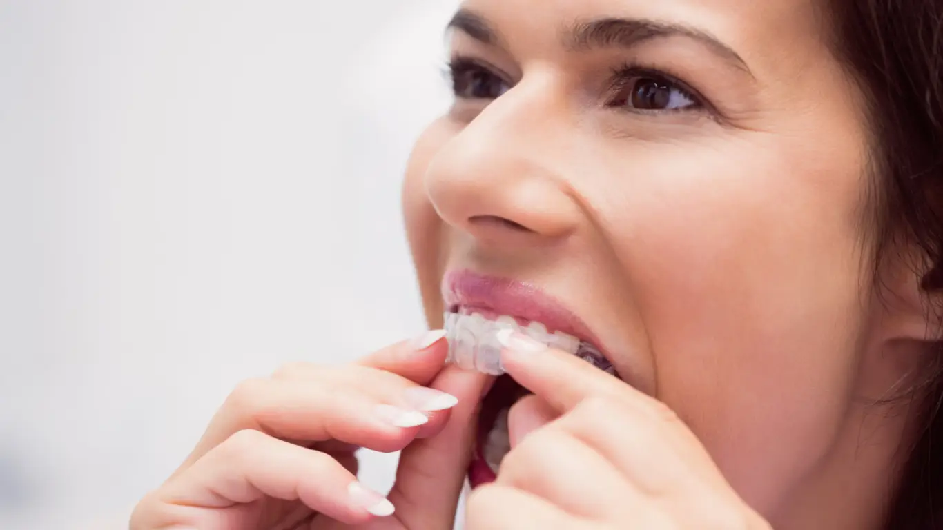 Orthodontic treatment at York Orthodontics