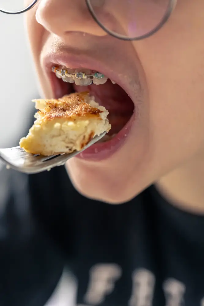 foods to avoid with braces